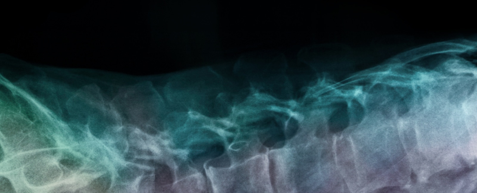 Laid Bare: Frida's Inner World